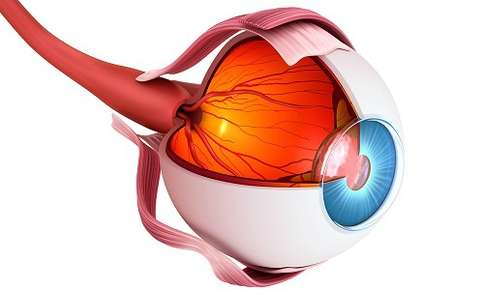 Signs of a Retinal Detachment