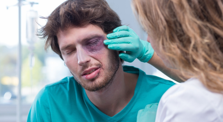 First Aid for Eye Emergencies